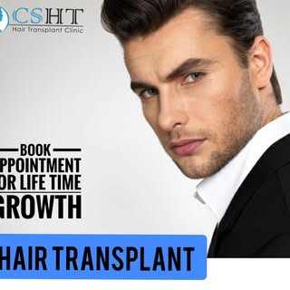 #hairtransplant #hairloss #hair #hairrestoration #fue #scalptattoo #alopecia #barber #scalpmicropigm