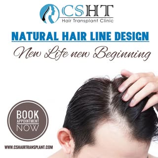 #hairtransplant #hairloss #hair #hairrestoration #fue #scalptattoo #alopecia #barber #scalpmicropigm