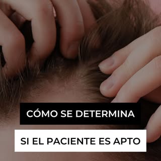 📌 ¿Eres candidato para un injerto capilar? Descúbrelo aquí 💇‍♂️✨

No todas las personas son aptas 