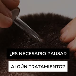 Si estás considerando un trasplante capilar, es importante saber si debes suspender algún medicament