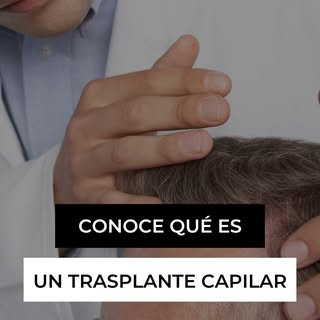 En este video te explicamos todo sobre el trasplante capilar, una solución efectiva para la calvicie