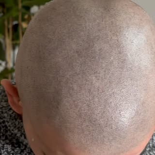 Se desideri un preventivo veloce spedisci le foto della tua testa su WhatsApp a questo numero
393.33