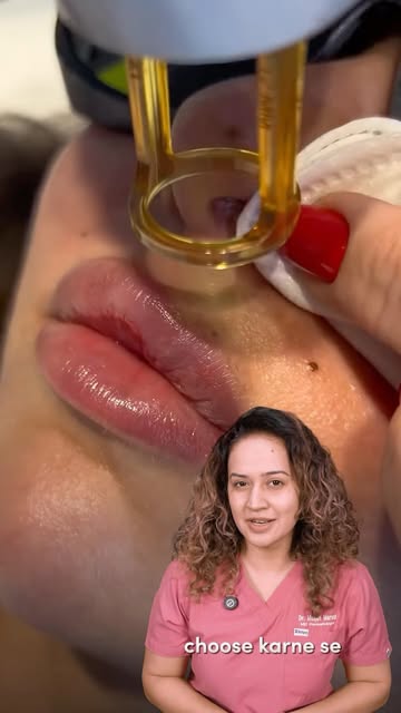 Must ask questions before finalising a laser hair reduction clinic! Watch till the 🔚