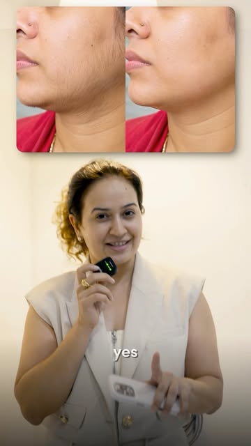 Laser hair removal or laser hair reduction?  They’re often used interchangeably, but they don’t actu