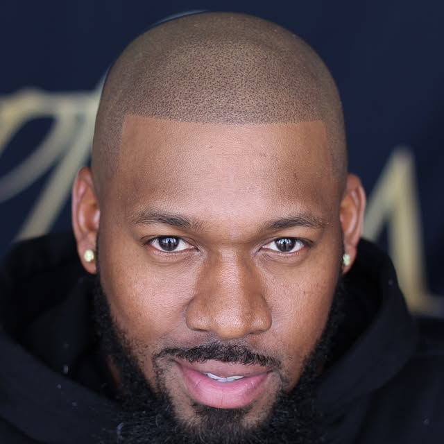 THIS IS A HAIR TATTOO—ALSO KNOWN AS SCALP MICROPIGMENTATION.

IMAGINE GOING FROM BALD TO HAVING THE 
