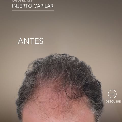 Para premiar la fidelidad de nuestros clientes, este verano hacemos una promoción de altura:

1950€ 