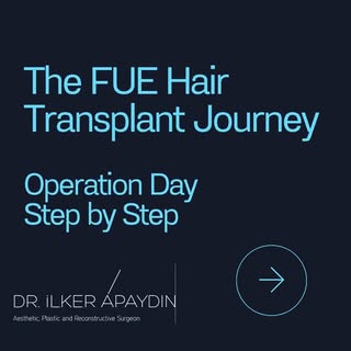 Thinking about a hair transplant? Here’s everything you need to know!

💡 Face-to-Face Consultation 