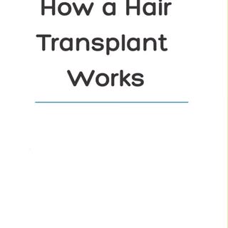 Behind every natural result is a team of skilled hands and focused minds.
Hair transplantation is no