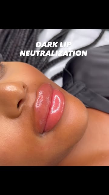 Dark Lip Neutralization ✨
Book via the link in bio or DM me if you have any questions 🤍