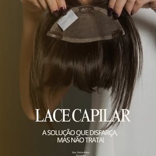 A lace pode devolver a aparência dos cabelos, mas não devolve o diagnóstico. Ela disfarça a falha ma