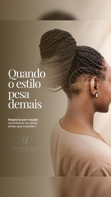 Nem sempre aquele simples rabo de cavalo é tão simples assim.

Quando o cabelo é preso com muita fre