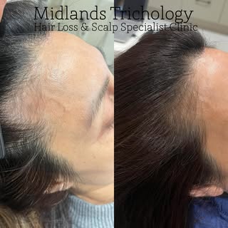 Combined treatments maximising results