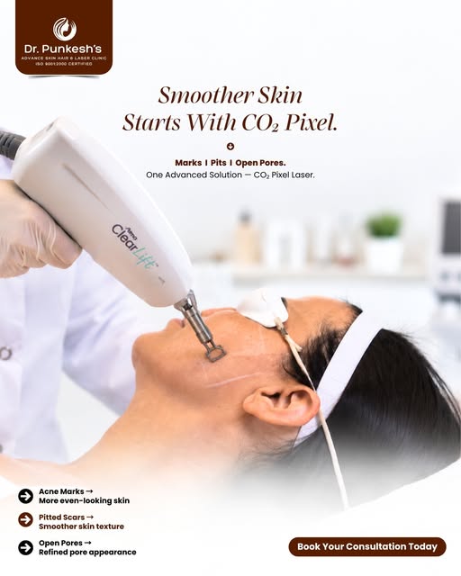Marks, Pits & Open Pores? Your Skin Deserves an Advanced Solution! 

Uneven skin texture, acne marks