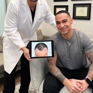 Dr. Nusbaum is with his patient Jose, now 1 year post-op! A total of 1,914 grafts were transplanted,