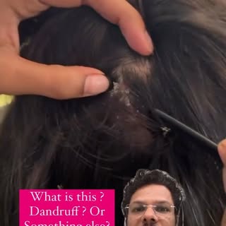 What is this ? how to treat ?