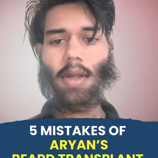 Worst beard transplant | Failed beard transplant | Hair loss #aryan_4u_guys #ryanclinic