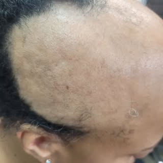 Book your consultation!
