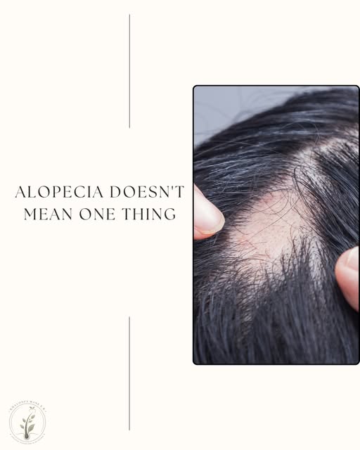 Alopecia doesn’t mean one thing. 💙

This is one of the conversations I really want us to have durin