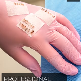Visually improve your hair density with modern, personalized treatments performed by specialists. Co