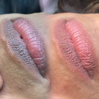 Before and Healed Results of Session 1 👏🏼 Dark Lip Neutralizing 💋

www.glamitbyvanessa.com

#LipB