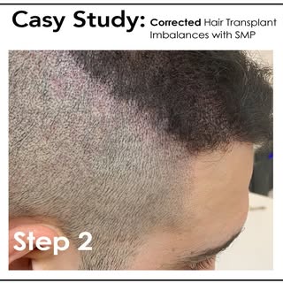 Achieving a better shape with pigmentation definitely takes hairline edges to the next level! This a