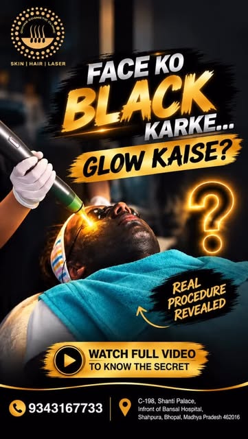 🖤 Black Mask? Don’t Be Scared! 😍

ये कोई डरावना mask नहीं, बल्कि Carbon Laser Facial का एक popular