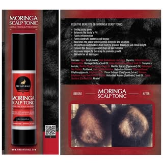 The Moringa Scalp Tonic should be used daily and as a part of your wash day routine.  A dermaroller,