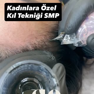 Doğal görünüm tesadüf değildir.
Kadınlara özel uyguladığımız kıl tekniği SMP ile seyrek alanlarda sa