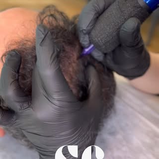 ✨Saçınızdaki seyrek alanları artık gizlemek zorunda değilsiniz!
Scalp Micropigmentation ile doğal bi