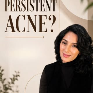 Acne keeps coming back even after treatment? I want you to look beyond the creams, too!

If I’m seei