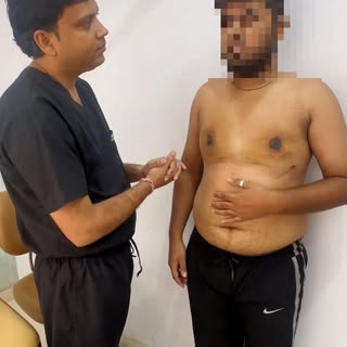💙 Real Patient. Real Experience. Real Results.

A satisfied patient shares his Gynecomastia Surgery