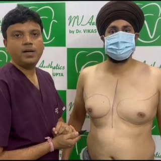Grade 2 Gynecomastia Surgery Result 

इस patient को Grade 2 Gynecomastia की समस्या थी, जिसकी वजह से 