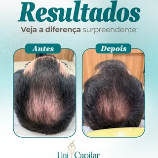 ✨ Resultados que mostram que estamos no caminho certo!

A recuperação capilar é um processo que exig