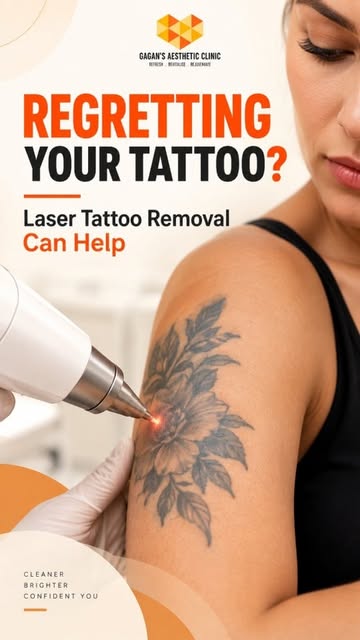 Tattoo pasand nahi aa raha? Regret kar rahe ho? You don’t have to live with it forever.
 
Using Q-Sw