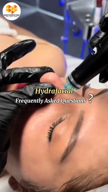 HYDRAFACIAL — YOUR FREQUENTLY ASKED QUESTIONS, ANSWERED! ✨

Wondering if HydraFacial is right for yo