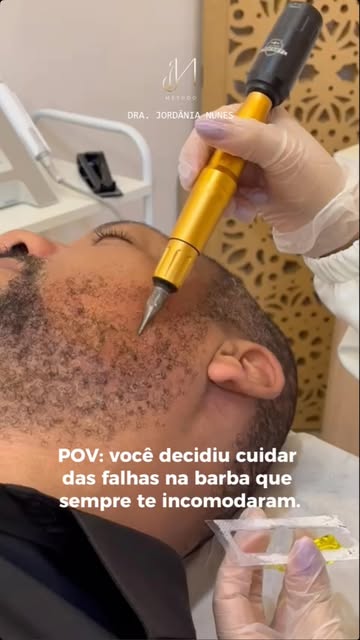 As falhas na barba não precisam ser algo que você simplesmente aprende a esconder.

Quando existem f