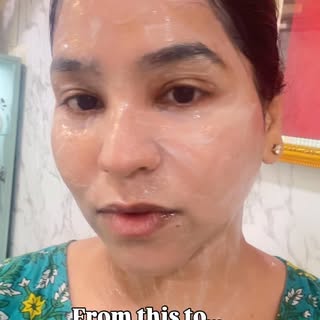 Motherhood changes your body… but your skin deserves care too 🤍
Postpartum dullness, pigmentation, 