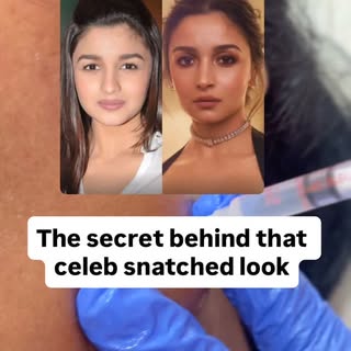 Is it really weight loss or Masseter Botox? 👀
> Notice how the lower face goes from broad & square 
