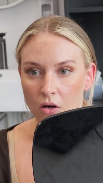Frisch statt verändert. ✨

Eine Botox-Behandlung kann dabei helfen, mimische Falten gezielt zu glätt