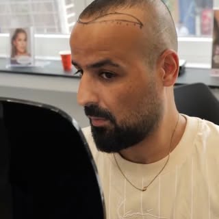 Eine gute Entscheidung beginnt mit einer ehrlichen Beratung.

Bei Alpha Beauty ist die erste Haarana