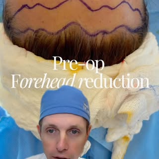 I want to walk you through this incision honestly, because I think it matters that you see the whole