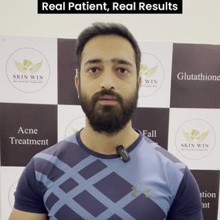 SkinWin Stories 💙
1 year post hair transplant — and the confidence says it all ✨
Our patient shares