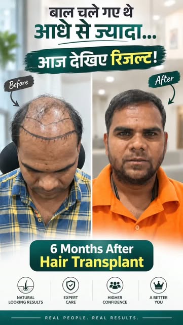 Hair Fall से परेशान थे? अब फर्क खुद महसूस कर रहे हैं! ✨

भगवान सहाय प्रजापत जी, जयपुर निवासी, ने अपन