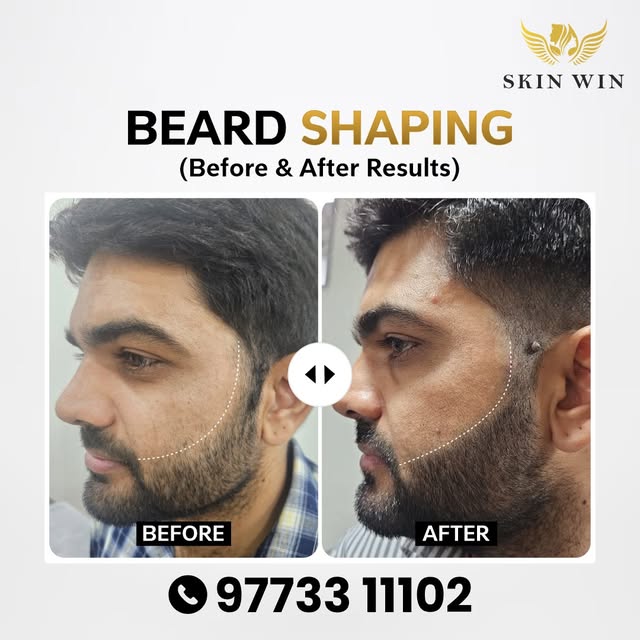 Your beard grows. But is your beard line actually defined? 👀

If your cheek line looks uneven, too 