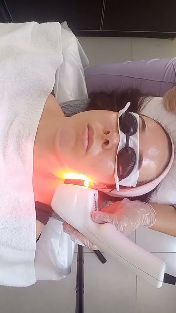 Muito além da Depilação a Laser... esta minha paciente decidiu além de ficar livre dos pelos, ter a 