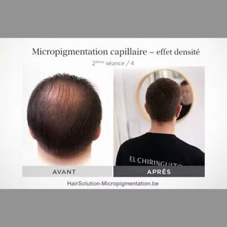 👉 Micropigmentation effet densité – séance 2/4
✔️ Résultat déjà visible
✔️ Effet cheveux plus fourn