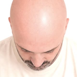 Micropigmentation capillaire effet rasé

Après une superbe année, les rendez-vous reprennent en sept