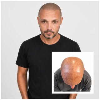 Effet rasé ultra réaliste ✨

Perte de cheveux ? Zones clairsemées ?
👉 Retrouve une apparence nette 