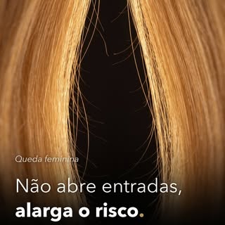 Na maioria das mulheres, a queda de cabelo não abre entradas como no homem. Alarga o risco, ao centr