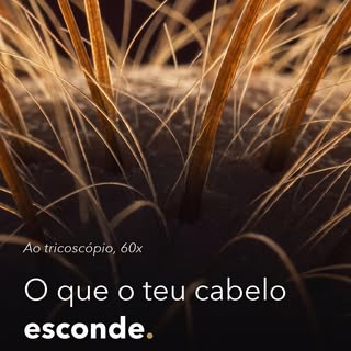 Isto é um couro cabeludo visto a 60 vezes, ao tricoscópio. E conta uma história que o espelho não co